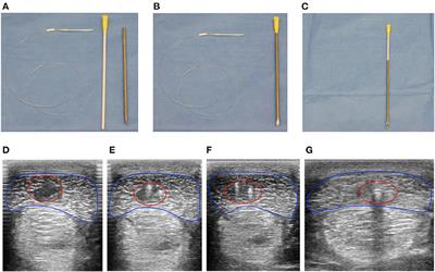 Interleukin-1β in tendon injury enhances reparative gene and protein expression in mesenchymal stem cells